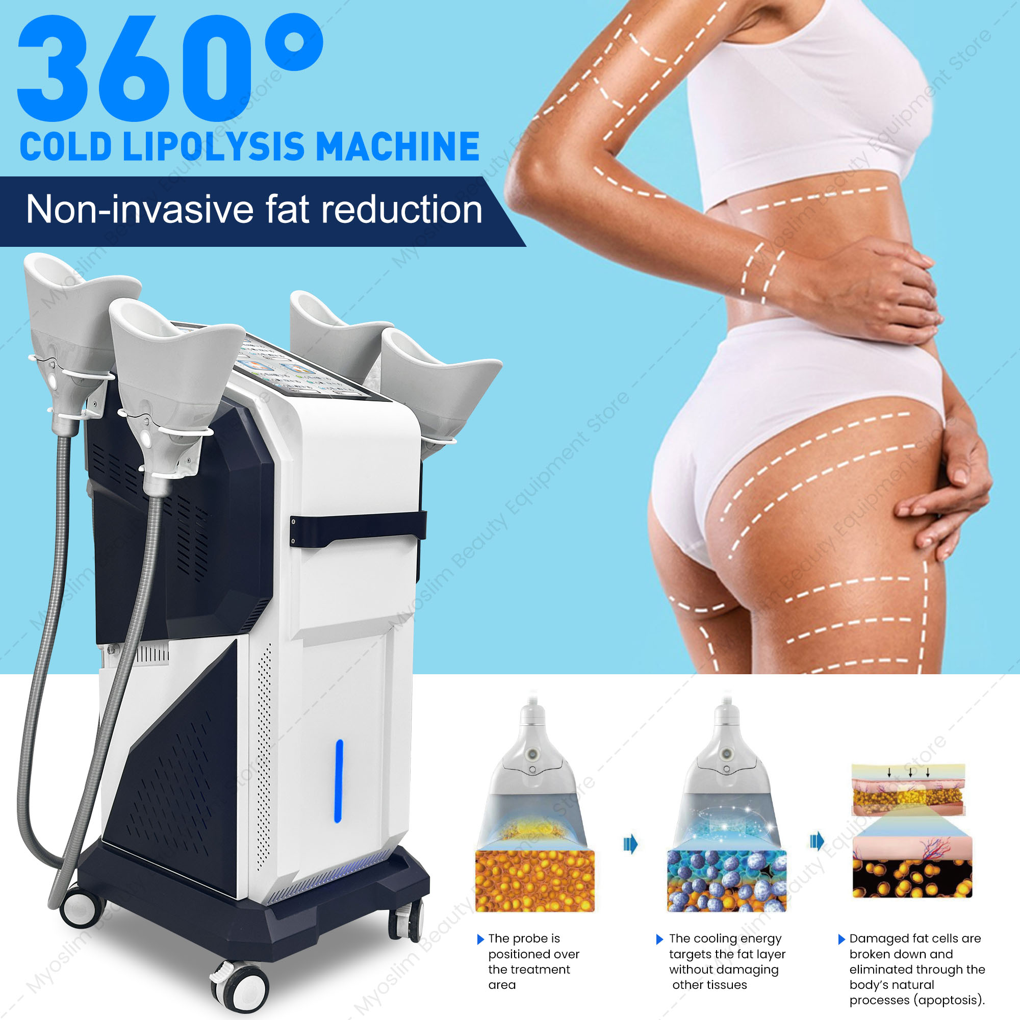 Cryolipolysis Fat Freezing Machine - Kryolipolyse-Gerät mit 4 Handstücken zur Körperformung,