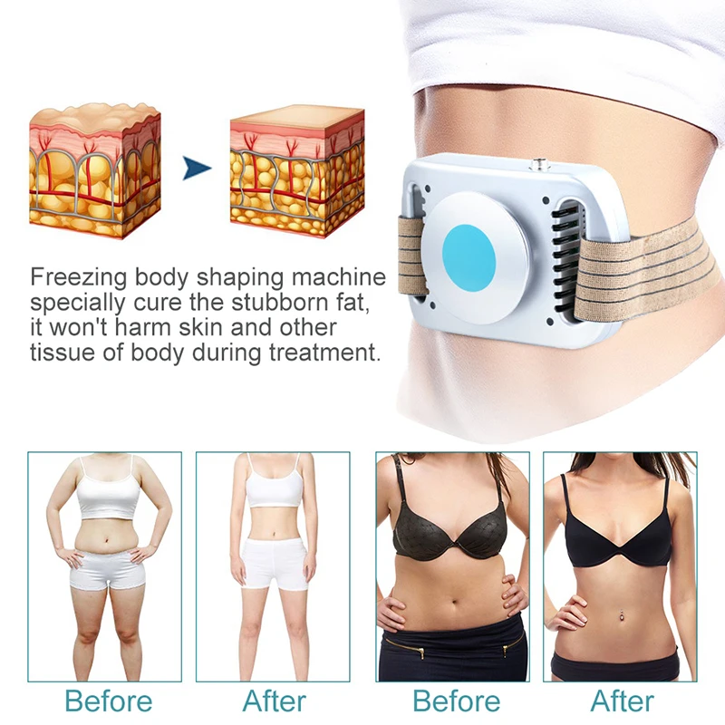 NEUE Kryolipolyse-Maschine zur – Cryolipolysis Fat Freezing Machine Bewertung und Preis