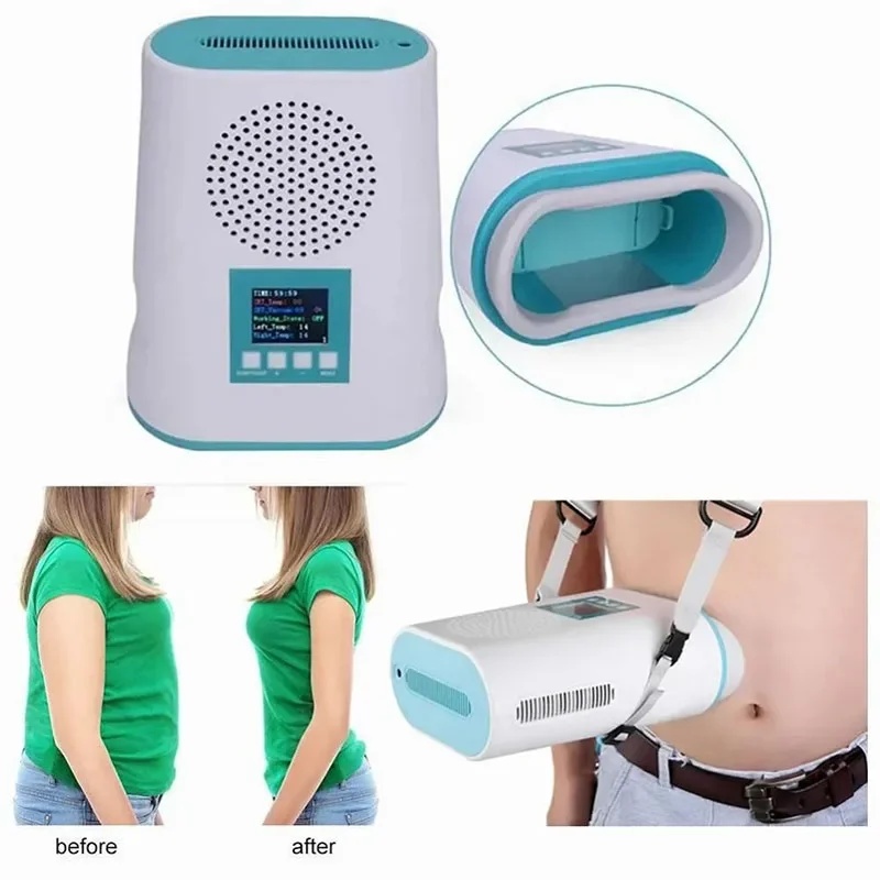 2026 Mini-Kryolipolyse-Gerät m – Cryolipolysis Fat Freezing Machine Bewertung und Preis