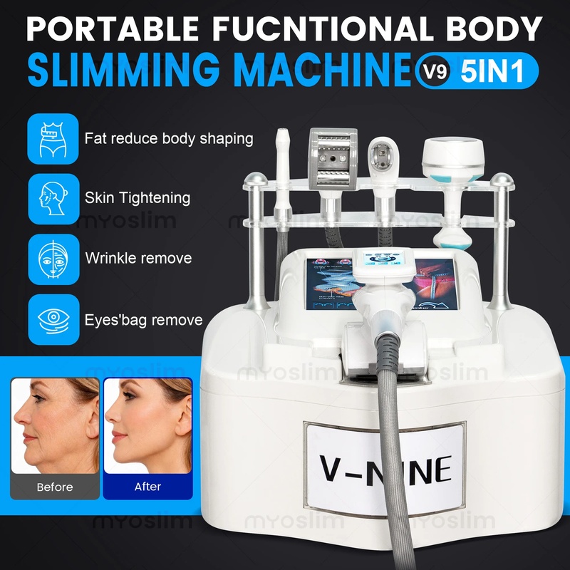 Tragbares V9 Vela Körperformun – Cavitation Machine 80K Weight Loss Bewertung und Preis